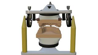 Occlusion Articulator parameters [upl. by Adias]