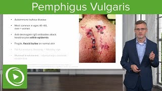 Pemphigus Vulgaris – Dermatology  Lecturio [upl. by Faun198]