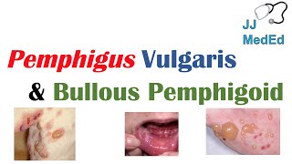 Vesiculobullous Skin Diseases  Pemphigus Vulgaris vs Bullous Pemphigoid [upl. by Bevers443]