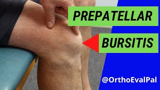 Prepatellar Bursitis Anterior knee pain and swelling [upl. by Jochbed]