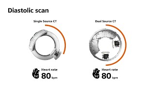 CT Scan of the Head A Radiologists Approach [upl. by Maxama]