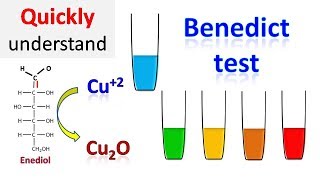 Benedicts test [upl. by Rafael]