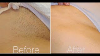 Brazilian Waxing 101 All You Need To knowTips [upl. by Yniatirb]