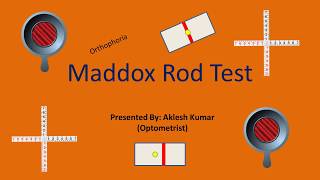 Maddox Rod Test [upl. by Ryhpez]