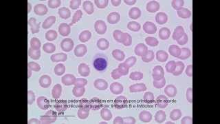 Classificação de Leucócitos [upl. by Nilreb]