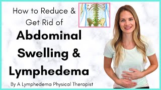 Abdominal Lymphedema and Swelling in the Stomach Treatment  By a Lymphedema Physical Therapist [upl. by Chrysler528]