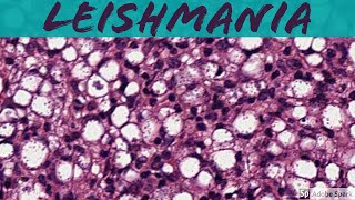 Leishmaniasis 5Minute Pathology Pearls [upl. by Perusse]