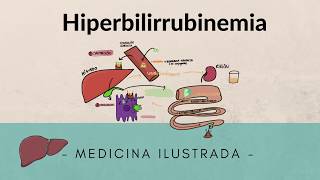 Metabolismo Bilirubina  Alteraciones [upl. by Dugas]