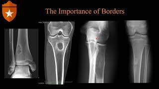 Basics of Bone Imaging [upl. by Chastain]