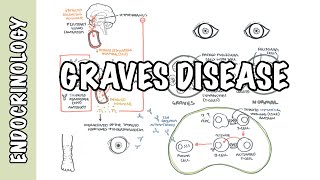 Graves Disease  Overview causes pathophysiology investigations and treatment [upl. by Cerys]