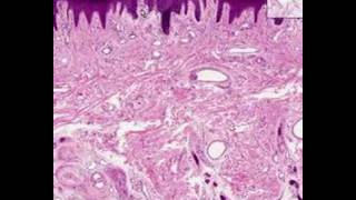 Shotgun Histology Thick Skin [upl. by Skolnik]