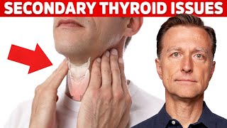 Most Thyroid Issues Are Secondary to Other Problems – Dr Berg [upl. by Olenolin]