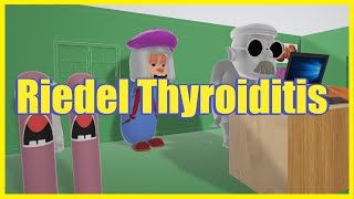 Riedel Thyroiditis Mnemonic for the USMLE [upl. by Dadirac]