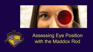 CITV 4  Maddox Rod amp Eye Position Testing [upl. by Ragnar]