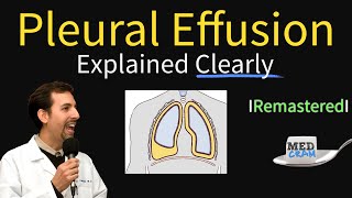 Pleural Effusions  Causes Diagnosis Symptoms Treatment [upl. by Sinylg]