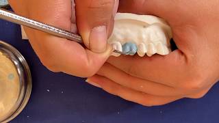 Encerado de un primer molar superior FACIL Paso a paso  upper first molar wax up [upl. by Anirtak]