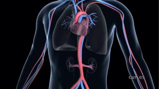 Transcatheter Aortic Valve Implantation TAVI [upl. by West]