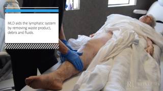 Manual Lymphatic Drainage MLD PostLipedema Surgery [upl. by Mabel534]