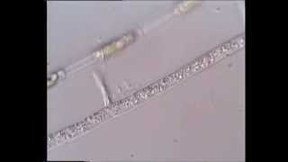 Cytoplasmic streaming in fungal hyphae [upl. by Atikahs]