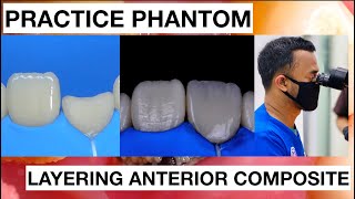 Step by Step Layering Anterior Composite  Finishing Polishing Composite  General Dentist Griya RR [upl. by Lilhak503]