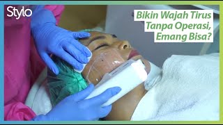 Cara Meniruskan amp Mengencangkan Wajah Tanpa Operasi dengan Treatment HIFU di Klinik Kecantikan Stylo [upl. by Acenes]