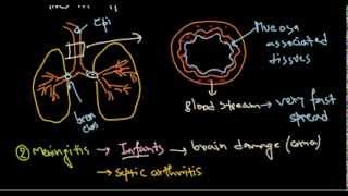 Haemophilus influenzae infection [upl. by Addam]