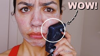 I Used Charcoal Black Soap On My Skin Everyday For One Week [upl. by Leakcim]