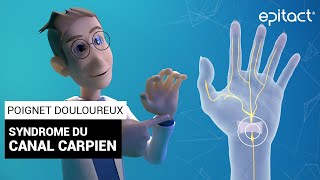 Syndrome du Canal Carpien  Explications – EPITACT [upl. by Analli100]