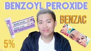 Benzac Benzoyl Peroxide 5 Review for Acne Philippines [upl. by Adaminah93]