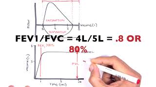 Understanding Spirometry  Normal Obstructive vs Restrictive [upl. by Rosalinda]