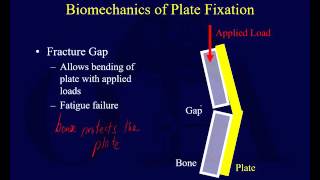 Orthopaedic Implants 1 [upl. by Taryn]