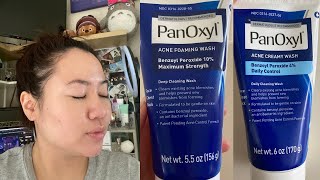 PanOxyl 10 vs 4 Acne Foaming Wash  Which is better for your skin [upl. by Klemens929]