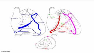 Common arterial trunk truncus arteriosus 4 chamber view [upl. by Iznekcam842]