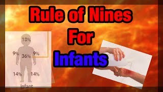 The Rule of Nines Explained Infant Version [upl. by Vivianne]