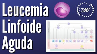 Leucemia Linfoide Aguda Explicada Claramente [upl. by Aicineohp]