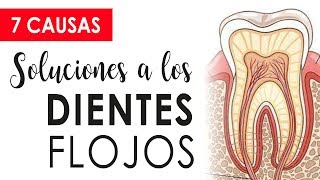 CUIDADO CON LOS DIENTES FLOJOS  CAUSAS Y SOLUCIONES 😱 [upl. by Lehcem320]