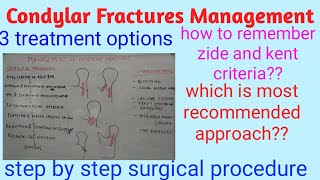 Condylar fractures management [upl. by Garzon]