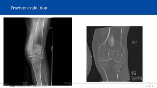 Introduction to Musculoskeletal Radiology [upl. by Adilen]