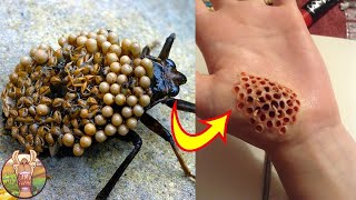 Faites ATTENTION Aux Piqures de Ces Insectes [upl. by Tiedeman]