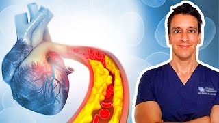 LDL HDL Triglyceride  Cholesterol Tests Explained [upl. by Mozes]