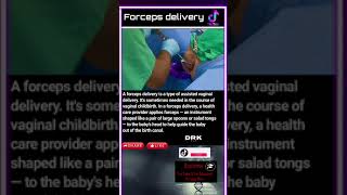 Forceps delivery [upl. by Elleinnod]