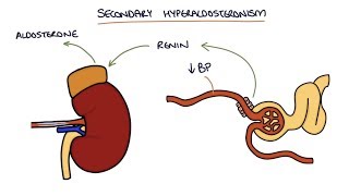 Addisons Disease  Overview clinical features pathophysiology investigations treatment [upl. by Barboza]