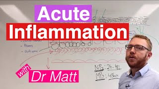 Acute Inflammation  Immunology [upl. by Etennaej]