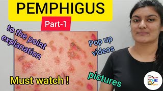 SKIN LESIONS PEMPHIGUS PART1 [upl. by Sinclare651]