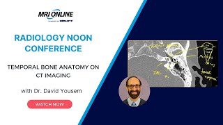 Temporal Bone Anatomy on CT Imaging w Dr David Yousem  Medality MRI Online Radiology Conference [upl. by Buseck706]