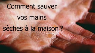 Comment sauver vos mains sèches à la maison  5 Méthodes efficaces [upl. by Harrow]