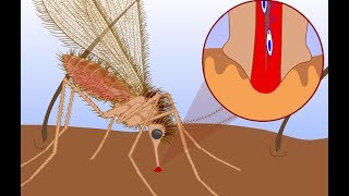 Leishmaniasis life cycle [upl. by Aroved]