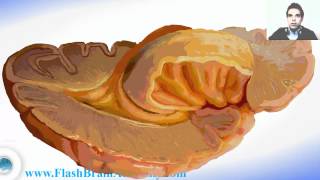 Brain Ventricles Anatomy And Insular Cortex [upl. by Ahsilam]