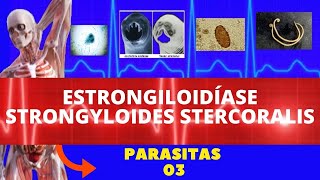 ESTRONGILOIDÍASE  STRONGYLOIDES STERCORALIS VERMINOSE  PARASITOLOGIA  INFECTOLOGIA [upl. by Yance]