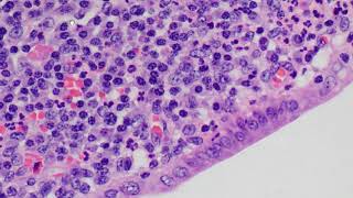 Leukocytes in histology [upl. by Virge]